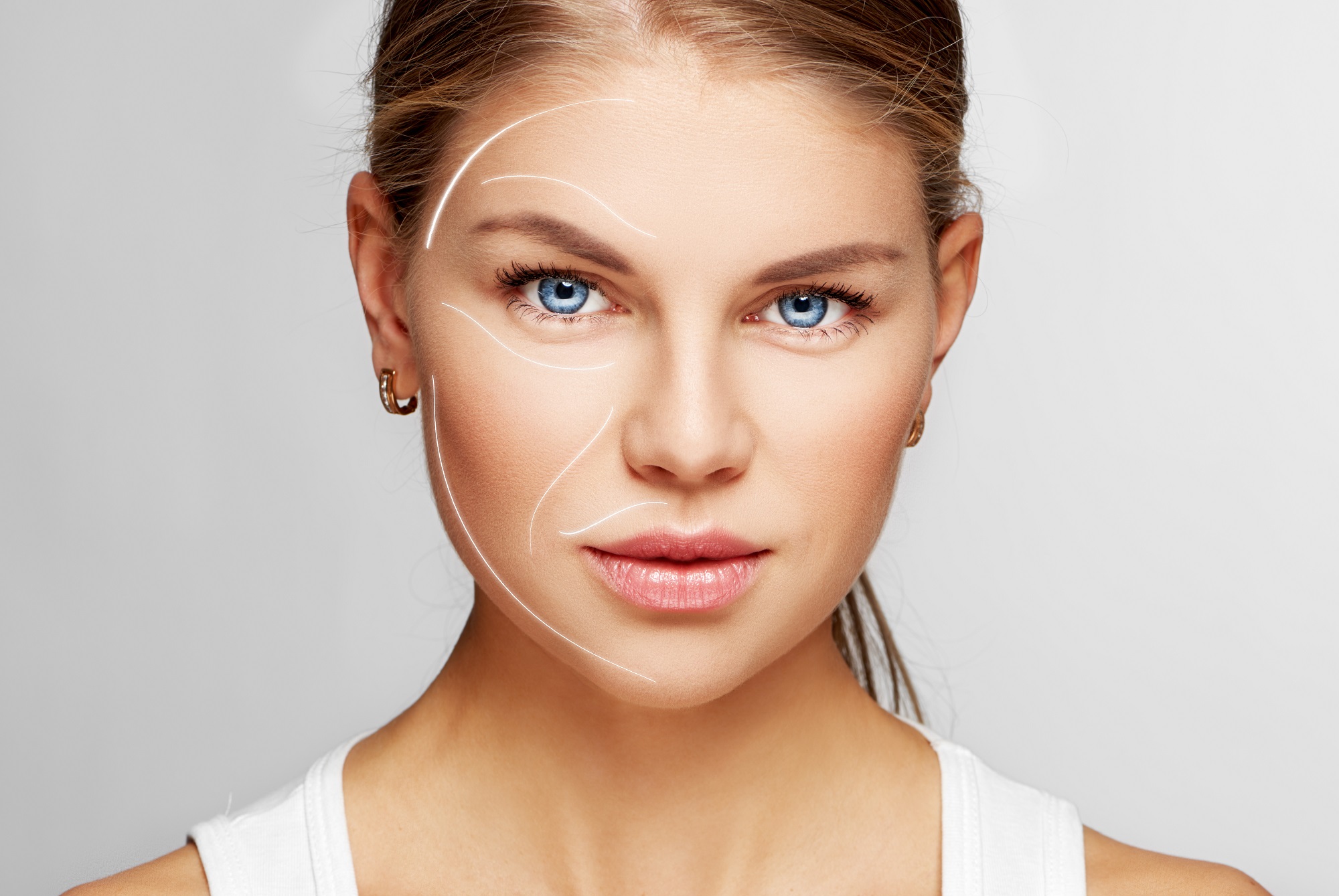 Facial Plastic Surgery in North Logan, UT