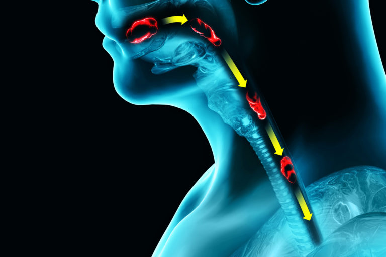 Swallowing and Speech Disorders Exercises and Remedies