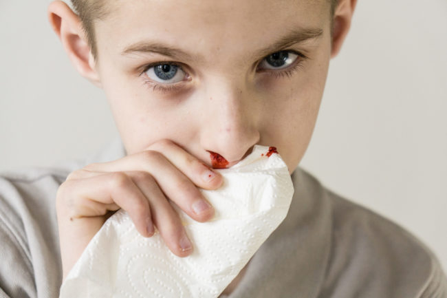 How Do I Prevent a Bleeding Nose Condition in the Summer?